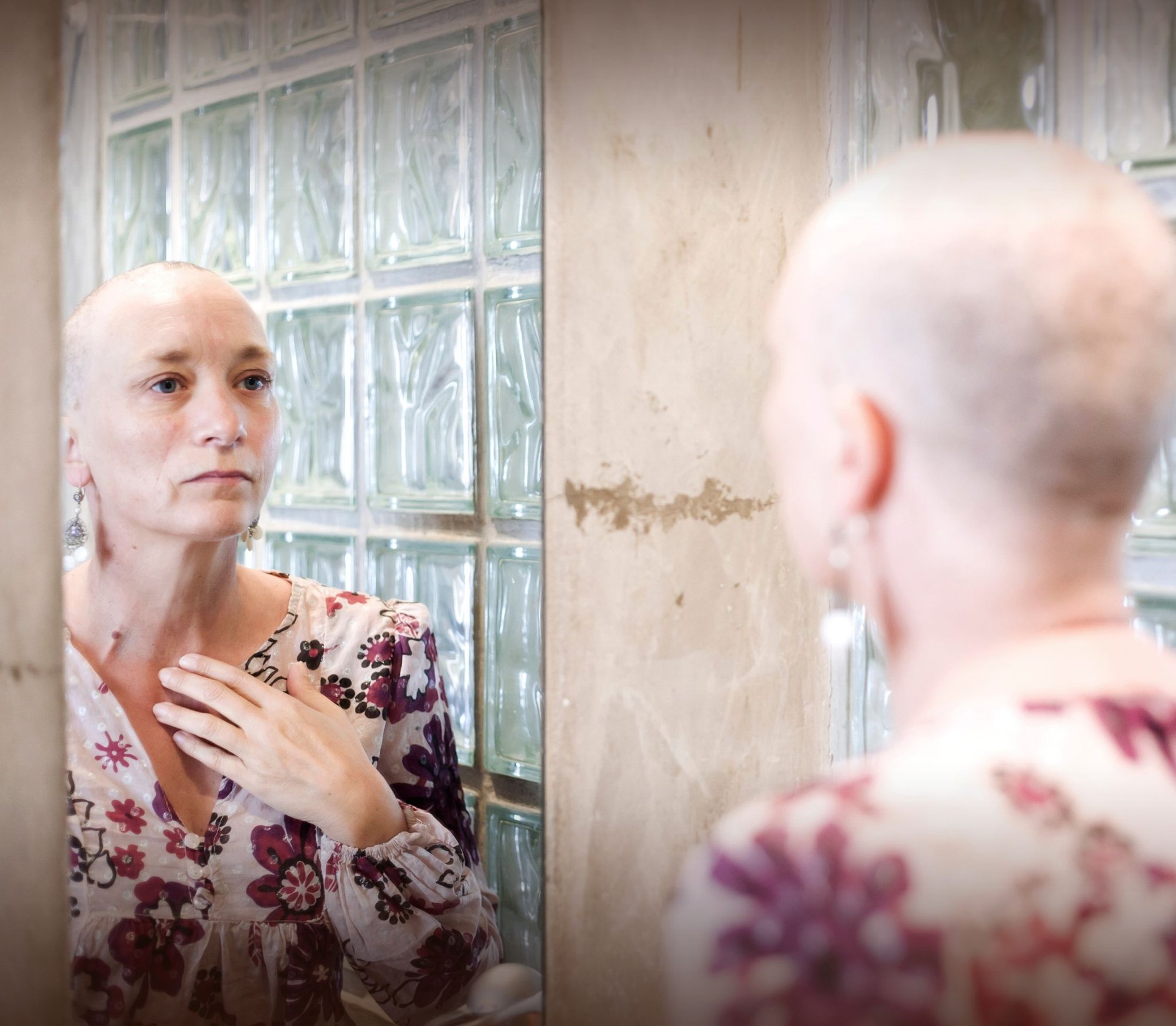 Kvinde med hårtab som følge af kræftbehandling ser sig selv i spejlet med et eftertænksomt blik.